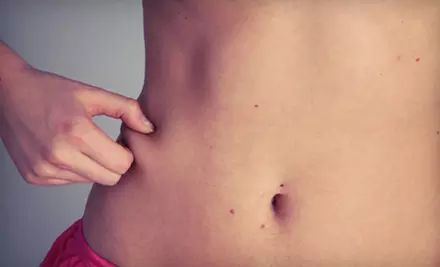 5, 10, or 15 Laser Cellulite Treatments at Aspasia Medical Solutions (Up to 64% Off) - Primary Image