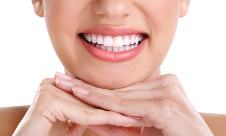 Smile Bright Teeth Whitening Smile Bright Teeth Whitening Groupon