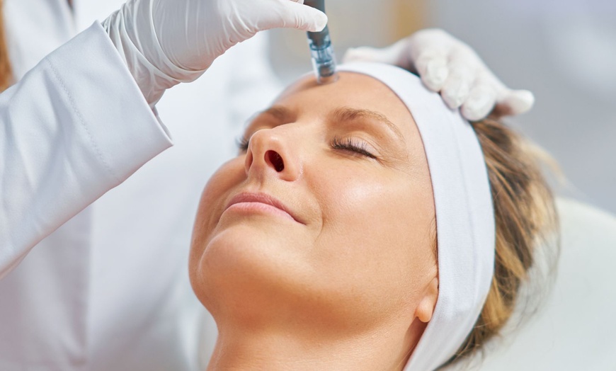 Image 6: Hasta 3 sesiones de microlifting facial de vitaminas con Dermapen