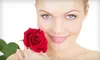 $50 for Microdermabrasion Treatment or Chemical Peel at Indian Land MedSpa in Fort Mill ($100 Value)