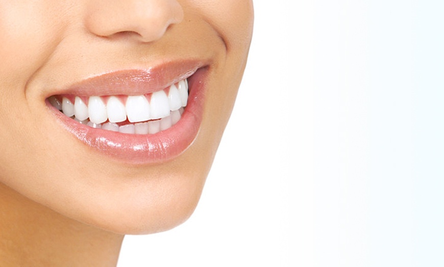 Image 3: Deep Dental Cleaning, Digital X-Rays, and Comprehensive Exam