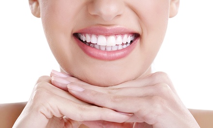 One 60-Minute Teeth Whitening Treatment - Gem Spa