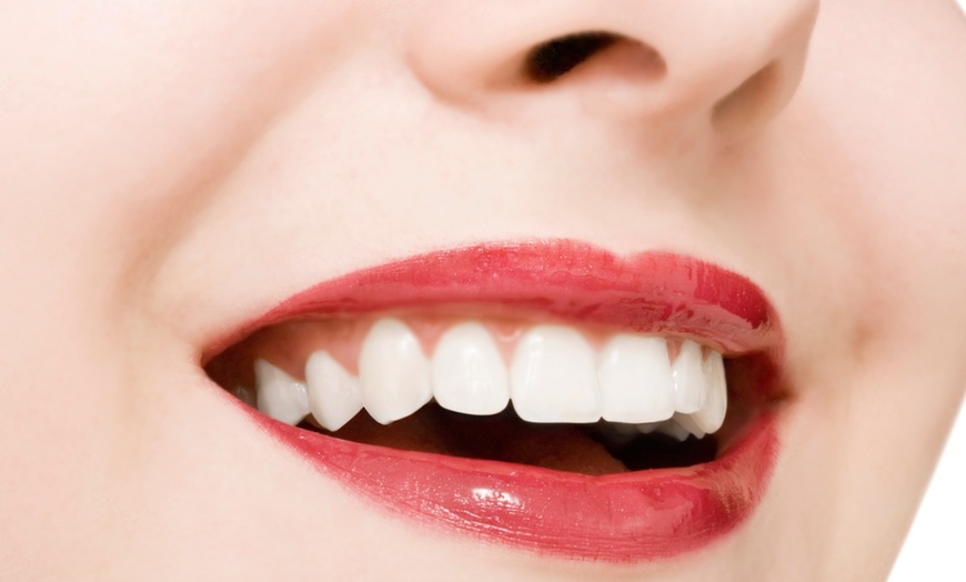 Dental Checkup - Quantum Dental | Groupon