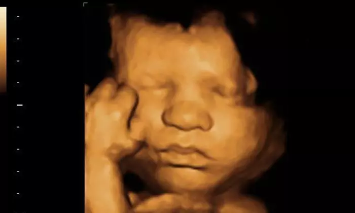 3D/4D Ultrasounds with Pictures or Pictures and Video at First Glimpse Imaging (Up to 53% Off)  - Primary Image