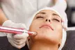 1 o 2 sesiones de dermapen con exosomas y limpieza facial para 1 persona, con hasta un 59% de descuento - Image 2