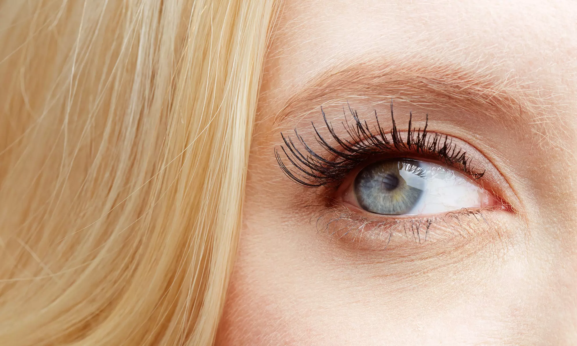 $74.50 for Dry-Eye Testing, Results, and Treatment for One at Elite Vision Center ($130 Value) - Primary Image