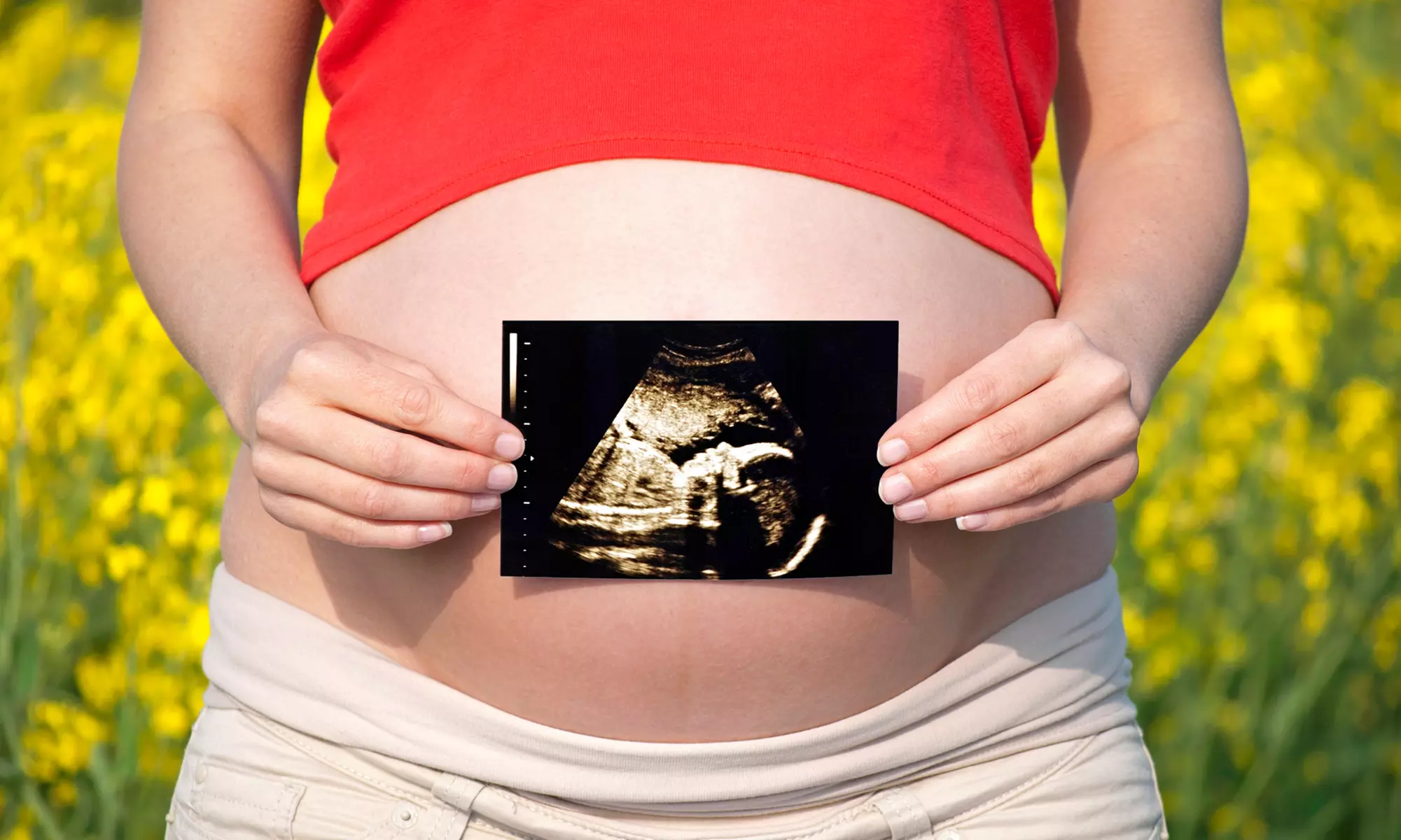 2D, 3D, or 4D DVD with Gender Check, Gender Determination, and Optional Gender Balloon (Up to 59% Off) - Primary Image