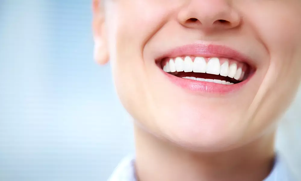 Dental Veneers from £179 at Pure Clinic (Up to 63% Off) - Primary Image