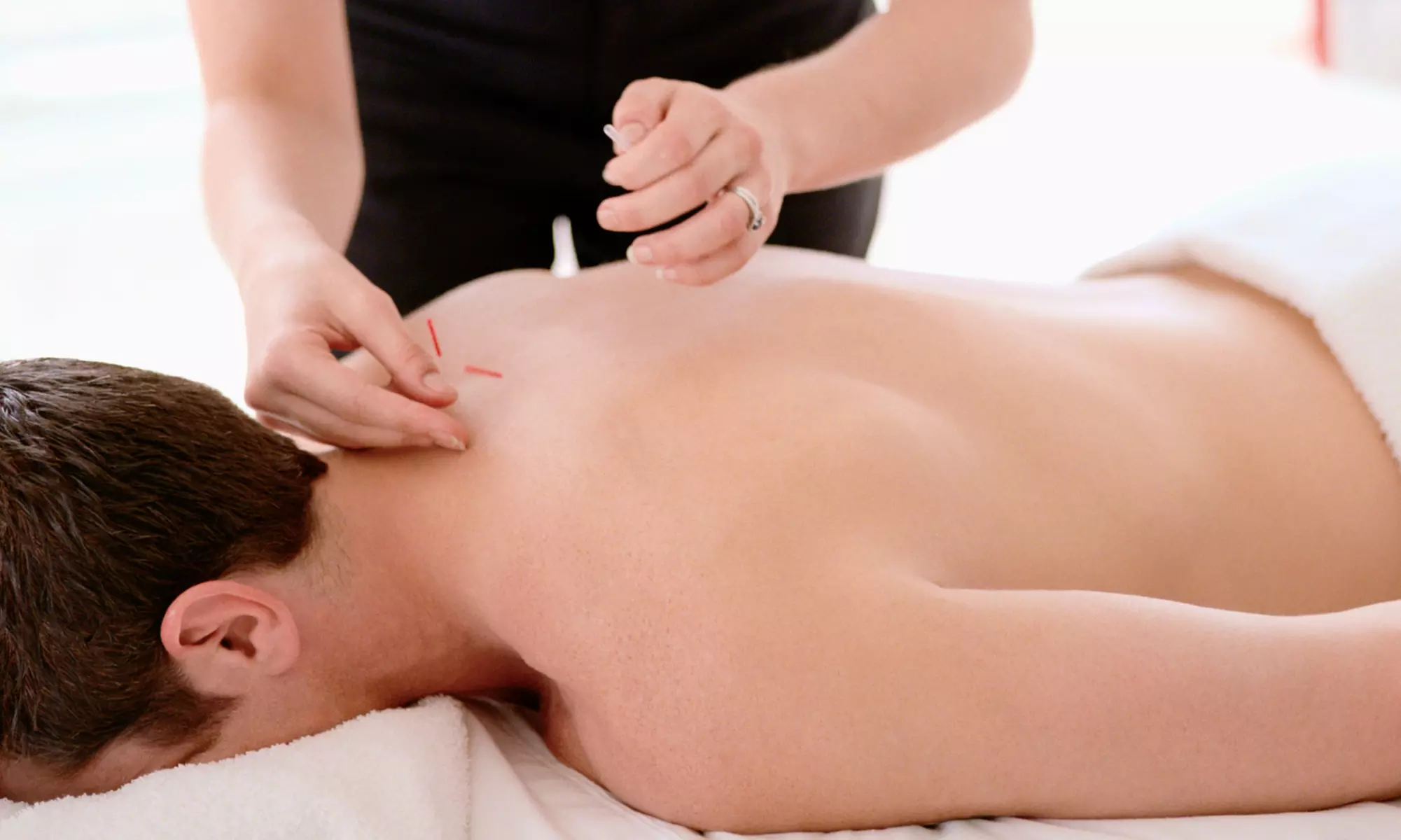 Experience holistic wellness at HealthQuest Chiropractic And Wellness Center with acupuncture sessions, up to 79% off - Primary Image
