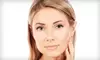 Two IPL Photofacials for a Small, Medium, or Large Area at Laser528 (Up to 80% Off)