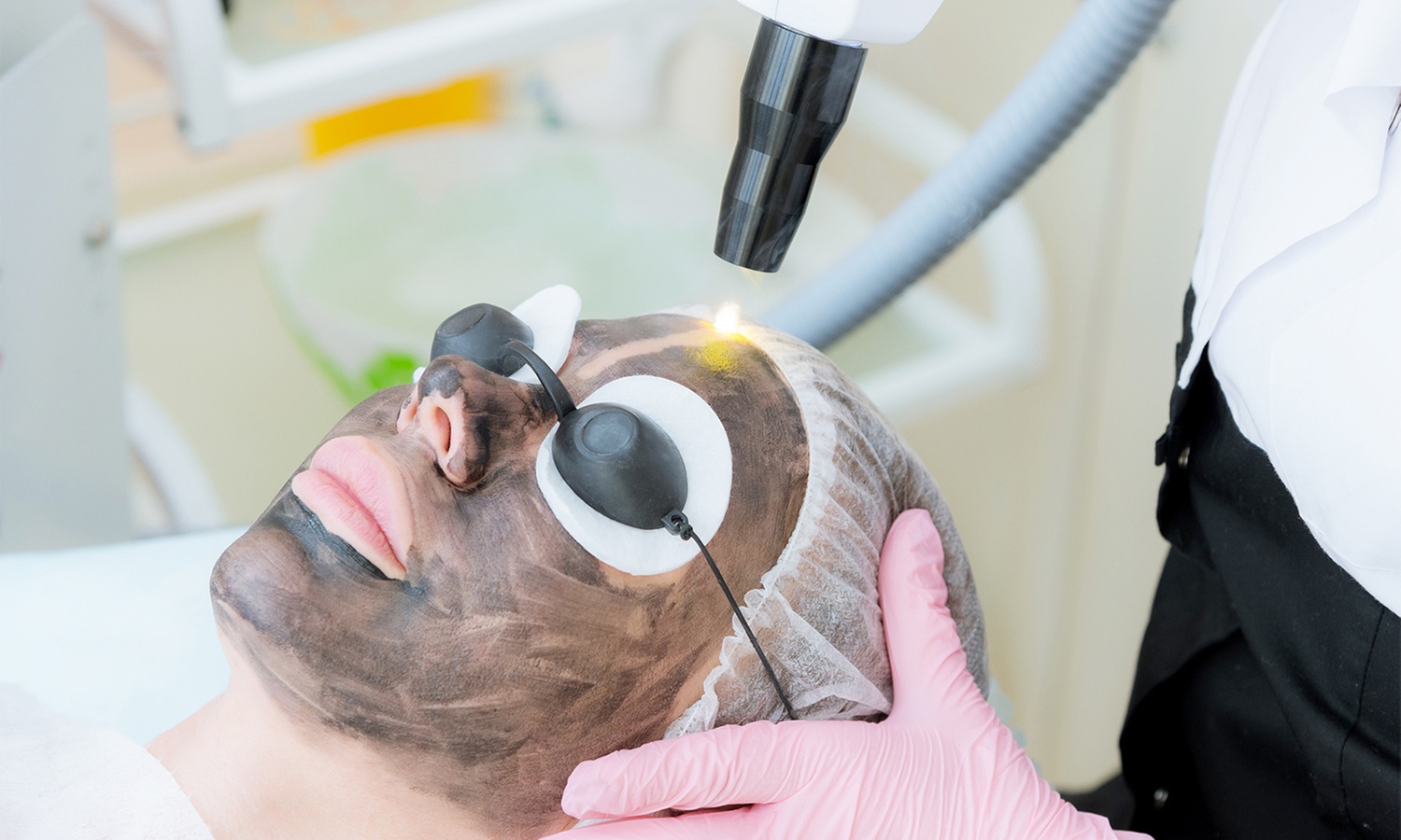 Up to 48% Off Carbon Laser Peel at Persona MedSpa