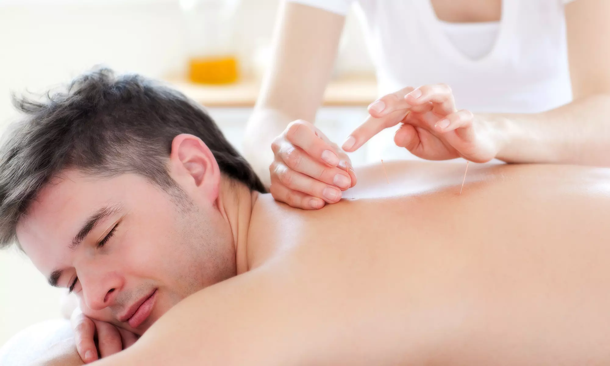 C$29.50 for a Consultation and One Acupuncture Treatment at Acussage TCM Clinic (C$75 Value) - Primary Image