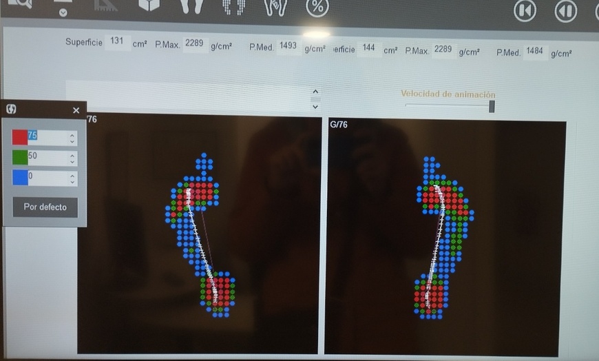 Image 5: Estudio de la pisada en Centro Ortopédico de Pamplona Piñeiro