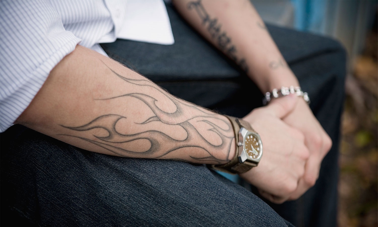 Eliminación de tatuaje con láser hasta -72%