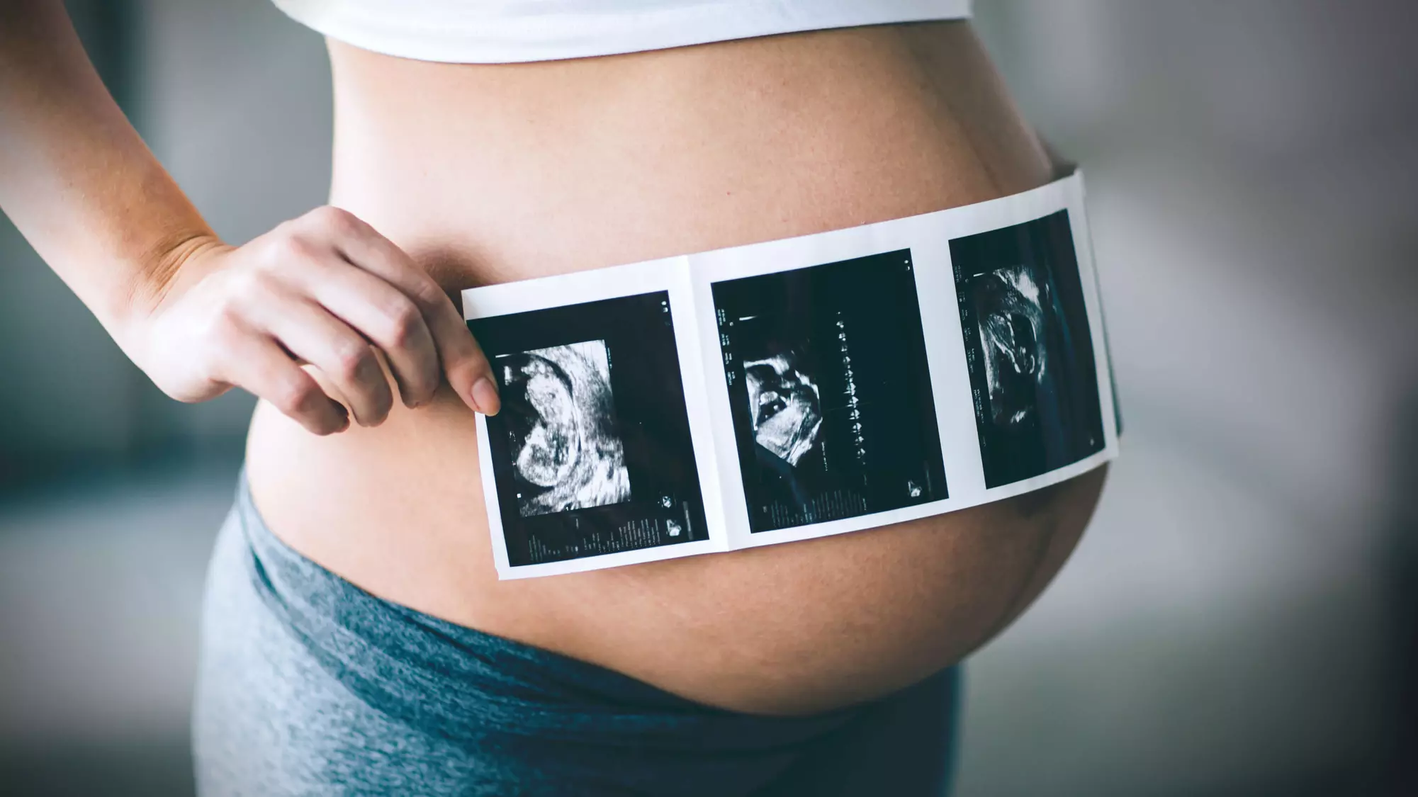 Gender-Reveal Plush or Ultimate Teddy Bear-Heart Package at Sneak a Peek Baby Ultrasound (Up to 36% Off) - Primary Image