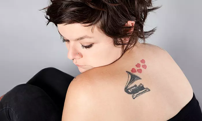 Laser Tattoo Removal: Three or Six Sessions from £39 at Matrix Clinicals (Up to 89% Off) - Primary Image