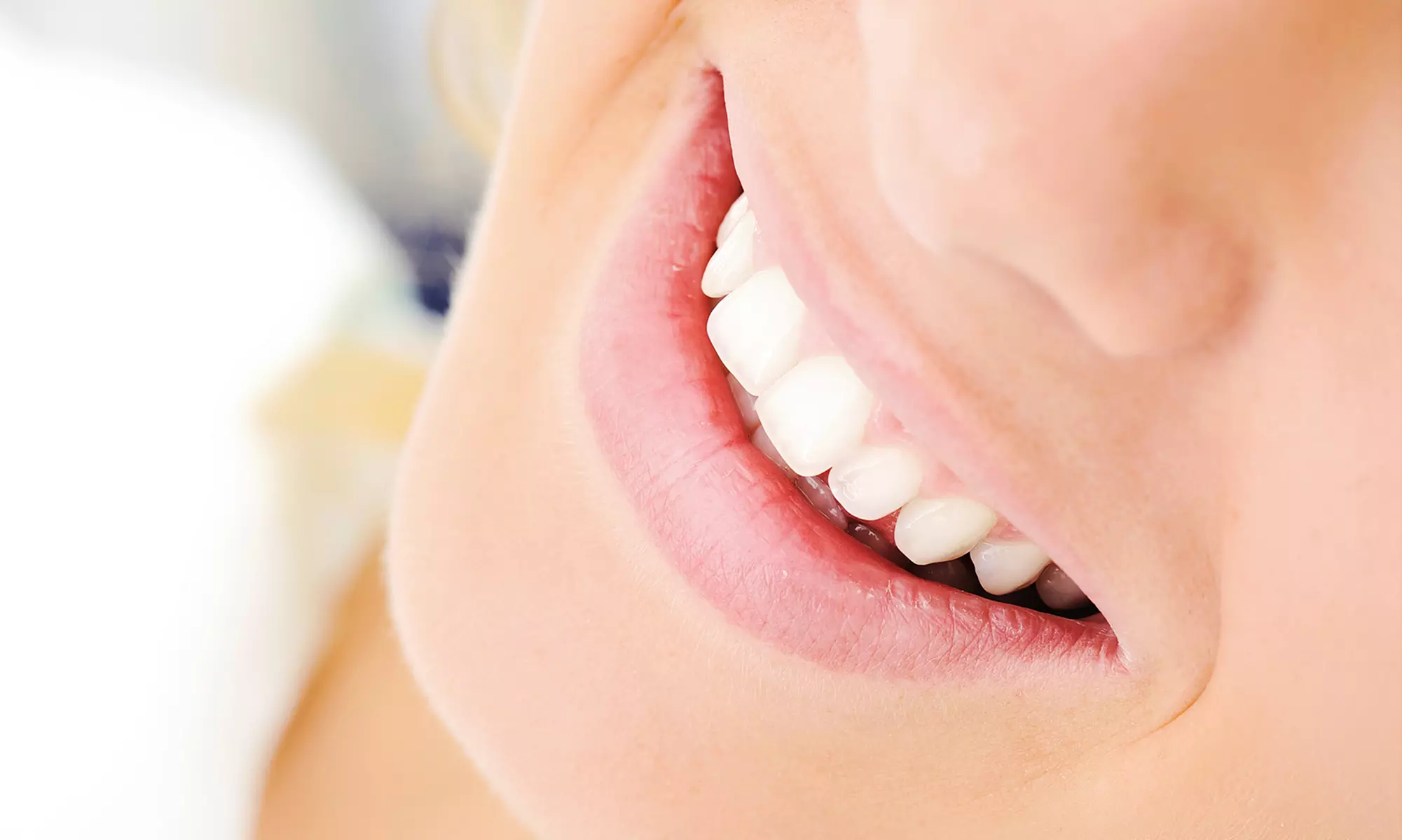 Curetaje e higiene dental