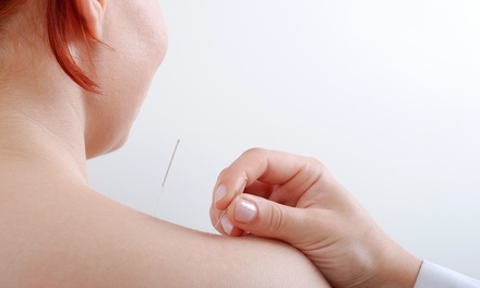 Consultation and Acupuncture - Lim's Acupuncture & Wellness | Groupon