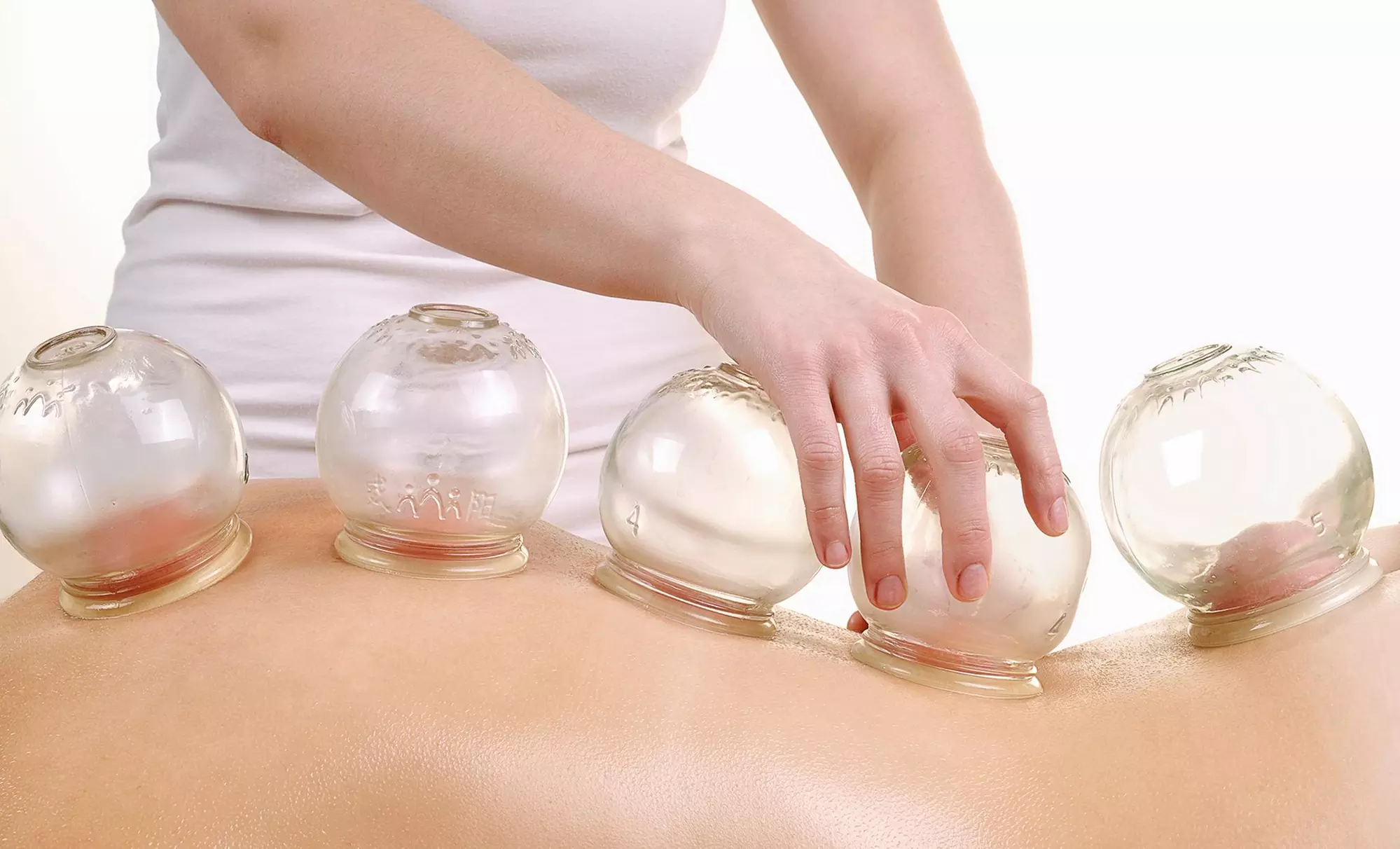 One 30-Minute Cupping or Four 30-Minute Hijama Sessions at AcuMeD Clinic Acupunctur and Herbs (Up to 50% Off) - Primary Image