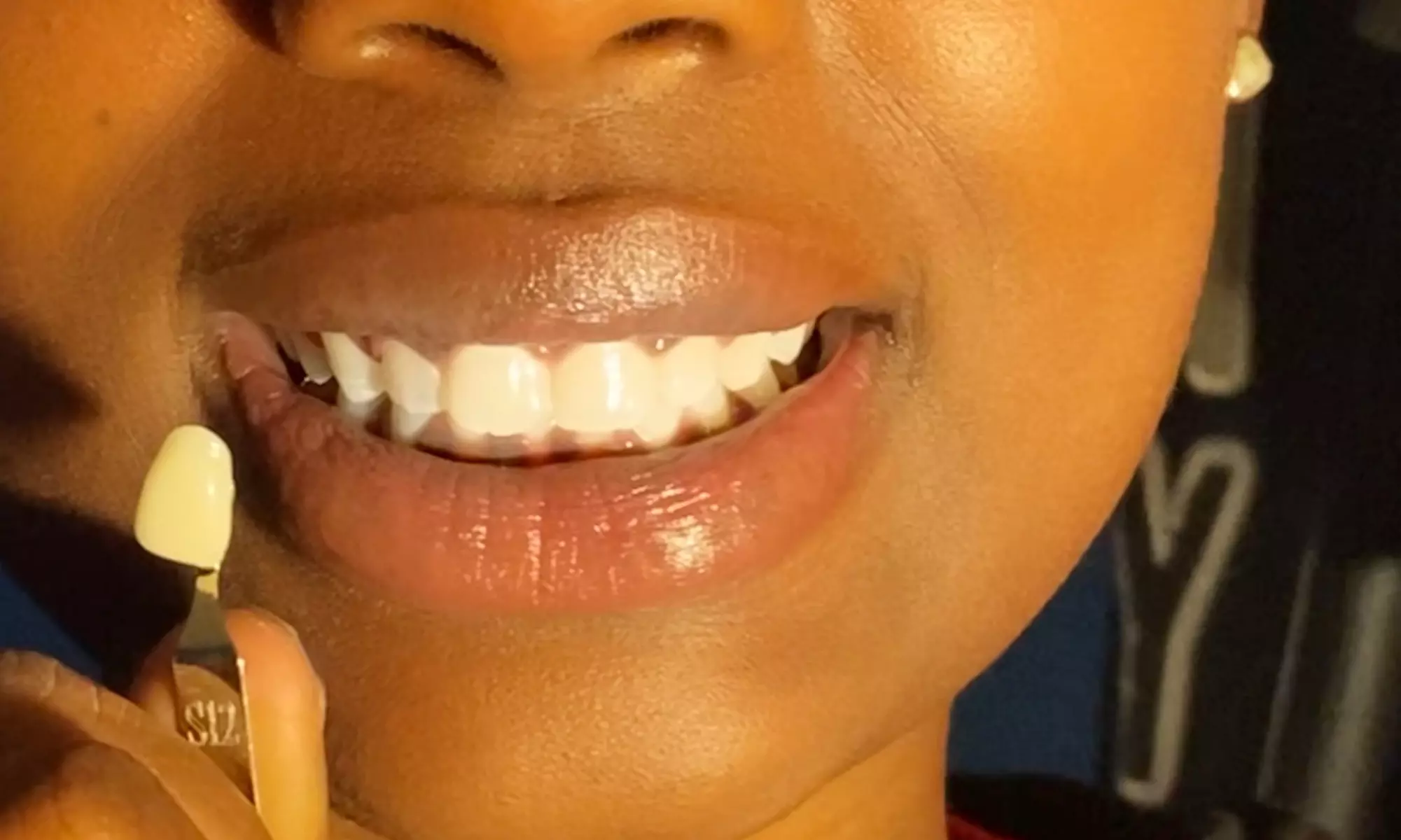 Up to 10% Off on Teeth Whitening - In-Office - Non-Branded at Smile Bigger with Danni - Primary Image