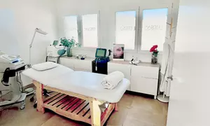 Reduce las arrugas con 1 o 2 sesiones de exosomas con Dermapen en rostro completo para 1, ahorra hasta un 70%