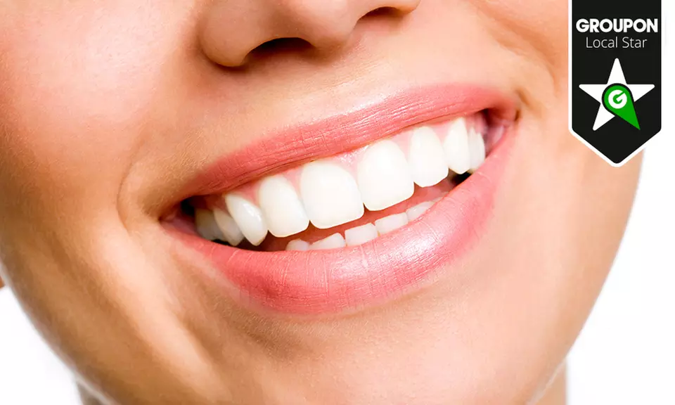 Limpieza bucal con opción a blanqueamiento dental led y kit de blanqueamiento desde 12,90 € en Clínica Dental Gama - Primary Image