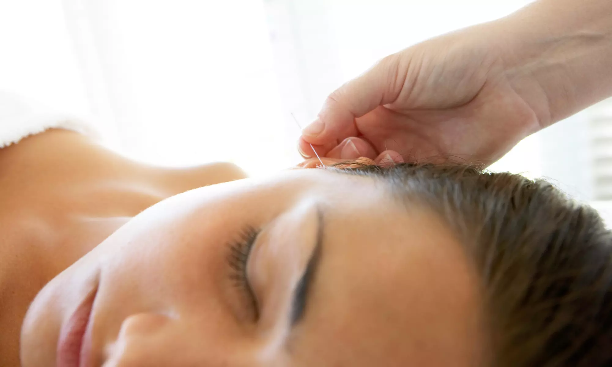 Up to 62% Off Acupuncture at South Point Acupuncture - Primary Image