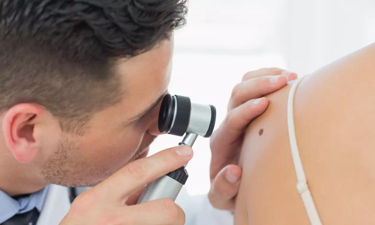 One Skin Tag Removal or 30-Minute Skin Tag Removal Session (Up to Six Tags) at The Glo Room (up to 48% Off) - Primary Image