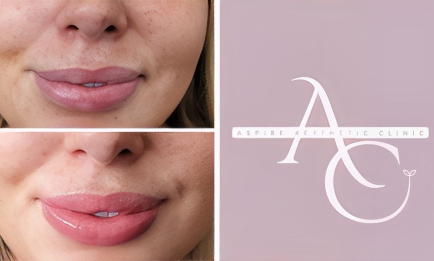 Image 3: Enhance your Lips with Expert Dermal Filler Treatments in Wembley!