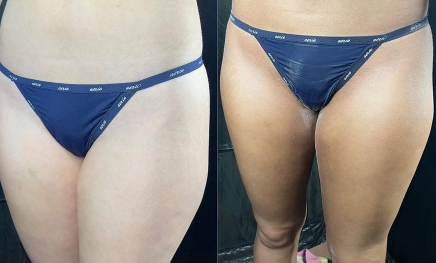 Image 4: 12-Week Acne Bootcamp with Personalized Skin Care and Weekly Check-Ins