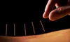 One or Three Acupuncture Sessions at Nicole Dunn, Acupuncturist & Holistic Therapist (Up to 55% Off)