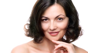 Up to 83% Off Microdermabrasions