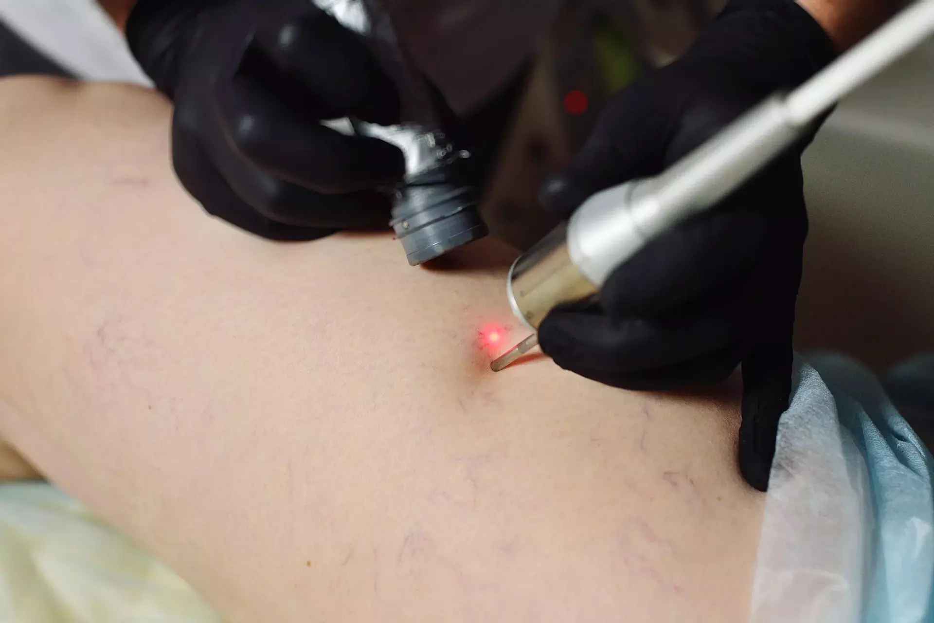 3 Sessions of Laser Hair Removal for a Small, Medium, or Large Area
