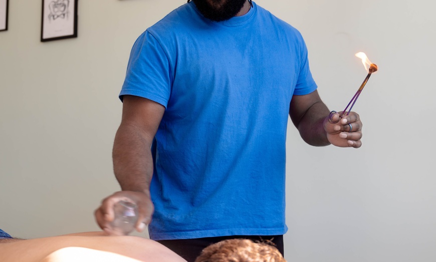 Image 7: Cupping with Deep Tissue Massage or Acupuncture in Shoreditch, London