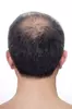 Scalp Micropigmentation Hair-Loss Treatment for Specific Area/Full Head at MFMicroblading (Up to 50% Off)