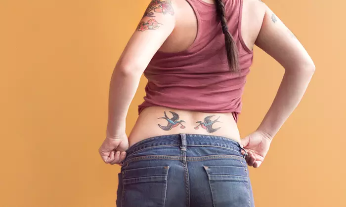 Three Laser Tattoo Removal Sessions on an Area Up to 4 or 9 Sq. In. at Calgary Anti-Aging Spa (Up to 87% Off) - Primary Image