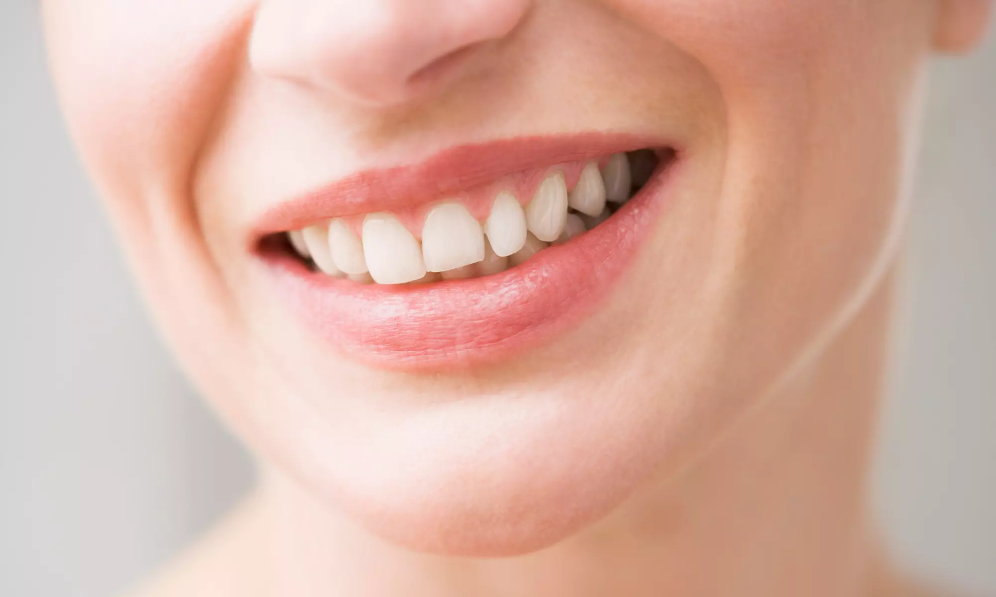 $125 for a 60-Minute Dental Checkup with X-Rays and Cleaning from Dr Ike Dental (50% Off) - Primary Image