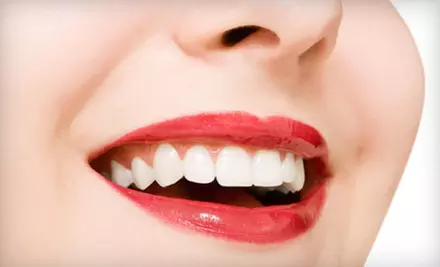 $2,799 for a Complete Invisalign Treatment from Moe Yazdi, DDS ($6,150 Value) - Primary Image