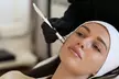 Get a Hydrafacial w/ Optional Hyaluronic Acid, Microdermabrasion, Dermaplaning or Radio Frequency (Up to 23%Off) - Second Medium