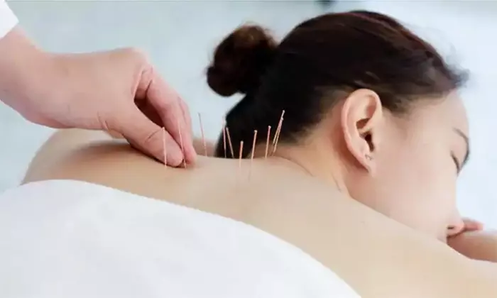 One 75-Minute Initial Exam and Treatment at Flowing Spring Acupuncture (Up to 35% Off) - Primary Image