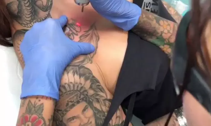 808 Laser Tattoo Removal (Up to 80% Off). Four Options Available. - Primary Image