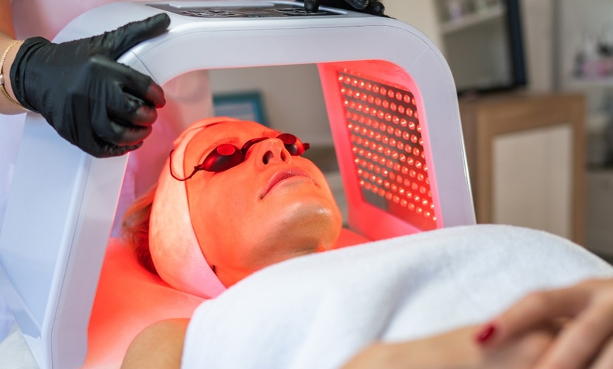 Image 1: Microdermabrasion, LED Therapy, and Radio Frequency for Full Face