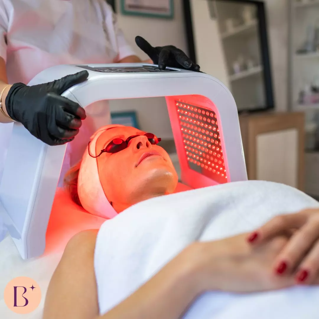 Microdermabrasion, LED Therapy, and Radio Frequency for Full Face