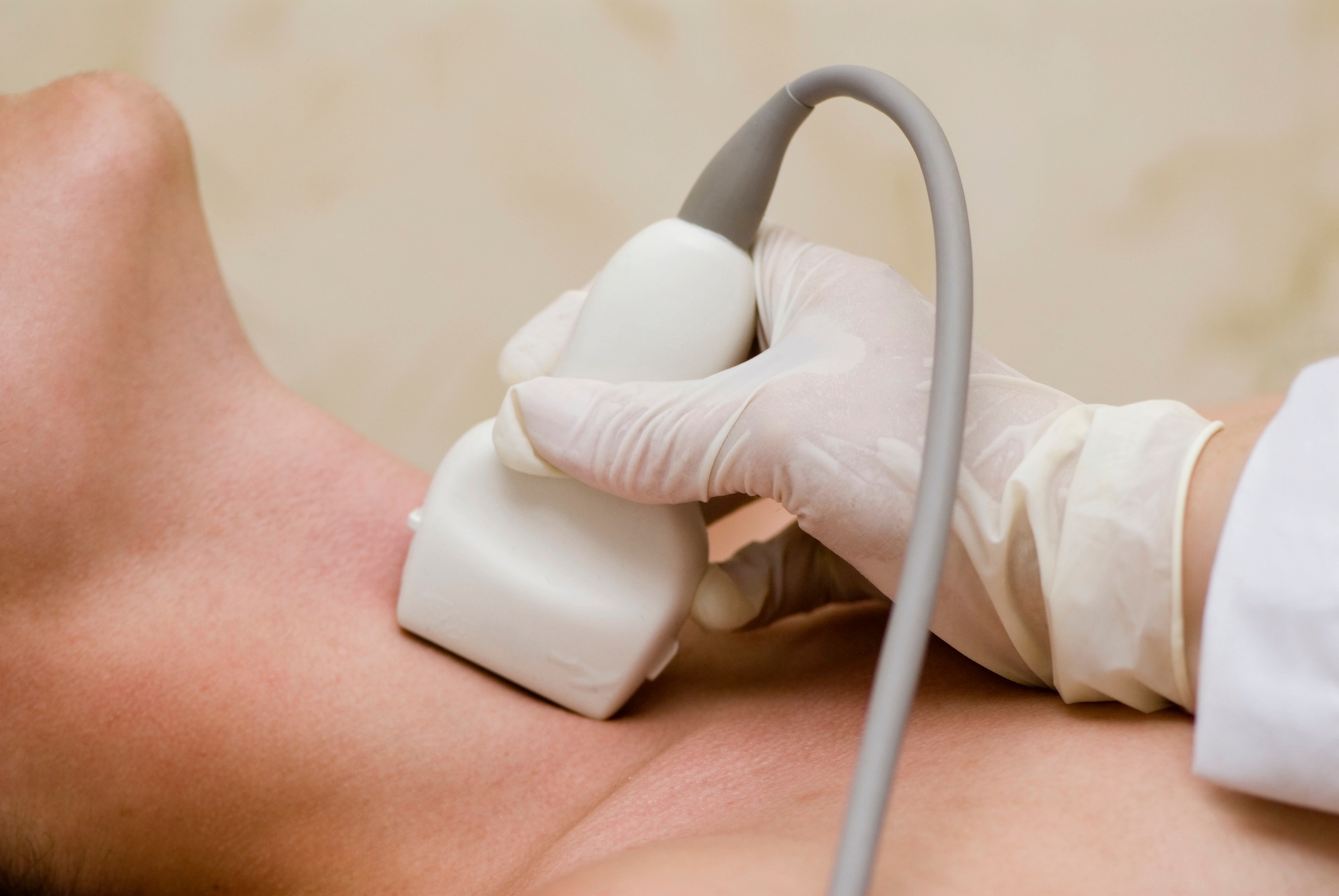 Thermolifting with options for two, four, or six sessions