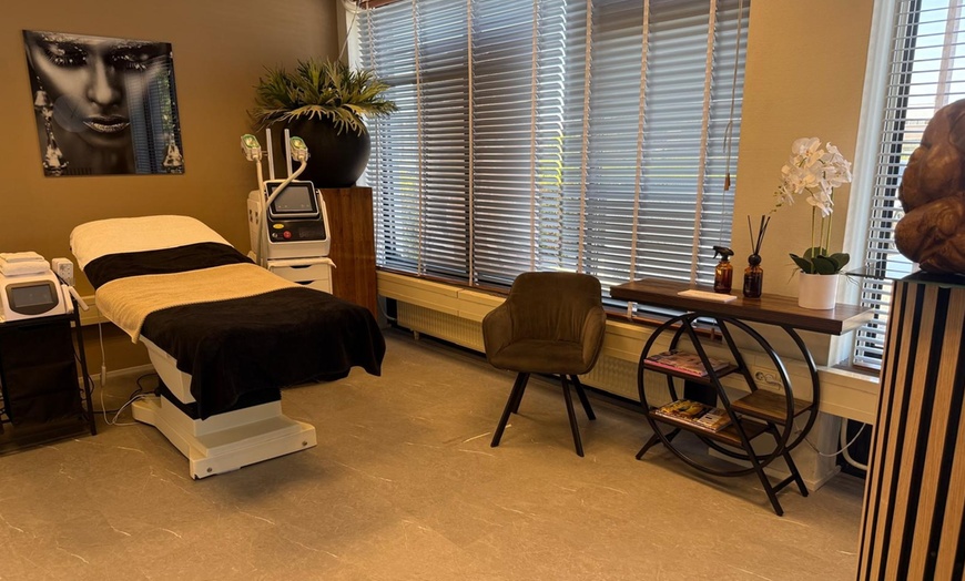 Image 2: Glow-up zonder filter: 1 of 3 carbon peeling behandelingen