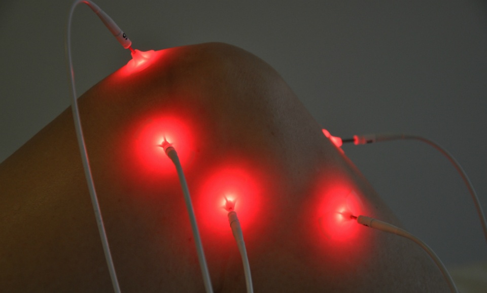 Low level laser acupunctuur therapie