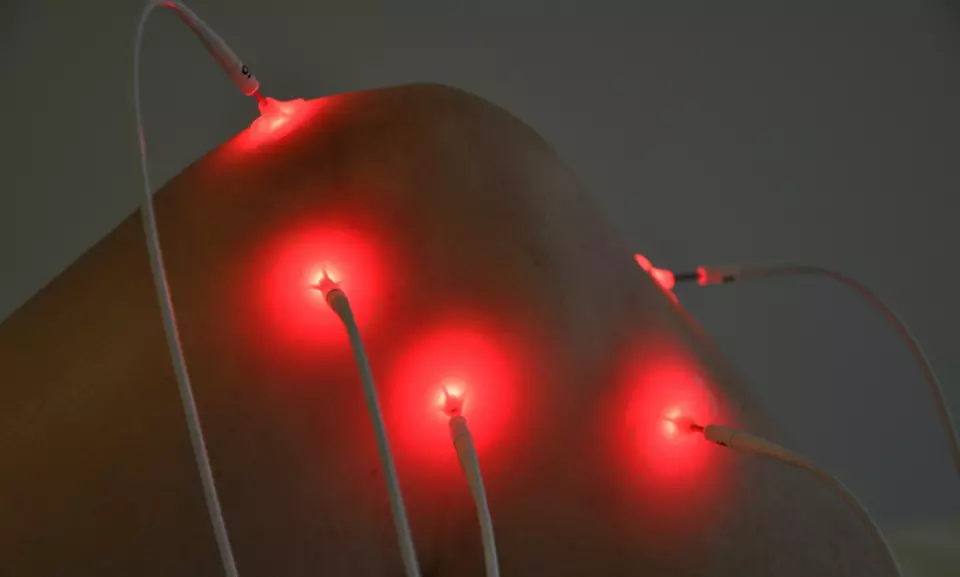 1, 2 of 3 low level laser acupunctuur-behandelingen bij Fu Lu Shòu - Primary Image