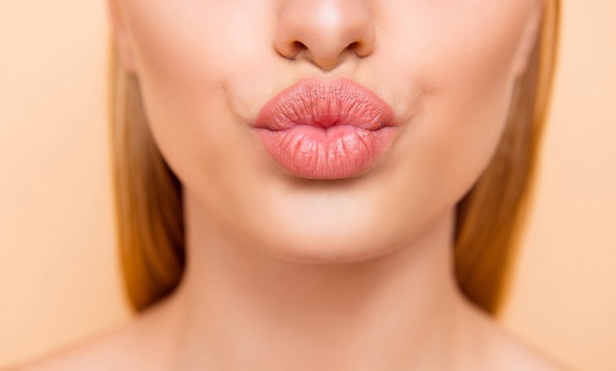 Image 1: Sesiones de rehidratación de labios con dermapen y vitaminas 