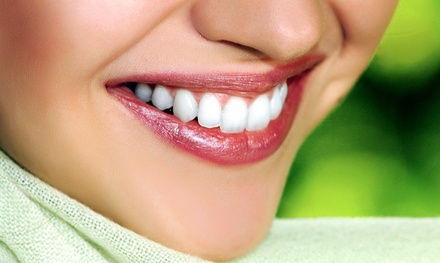 Orland Park Teeth Whitening Deals In And Near Orland Park Il Groupon