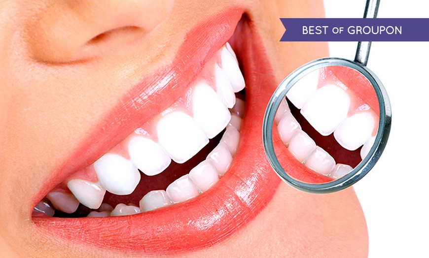 Image 1: Teeth Whitening